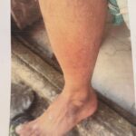 गायकावर मध्यरात्री कथित मारहाण;पोलीस कर्मचाऱ्यावर गुन्हा नोंदवण्याची मागणी